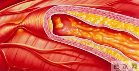 医生多次强调：最伤心脏的行为，不是饮食！而是频繁去做4件事
