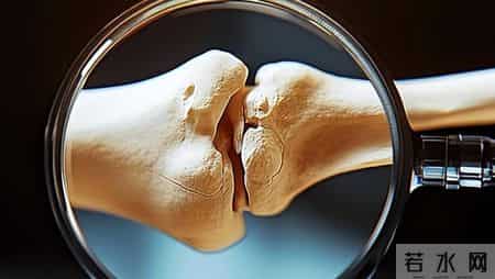 研究表明：天天走路锻炼的骨质疏松患者，不用多久，或迎来5变化