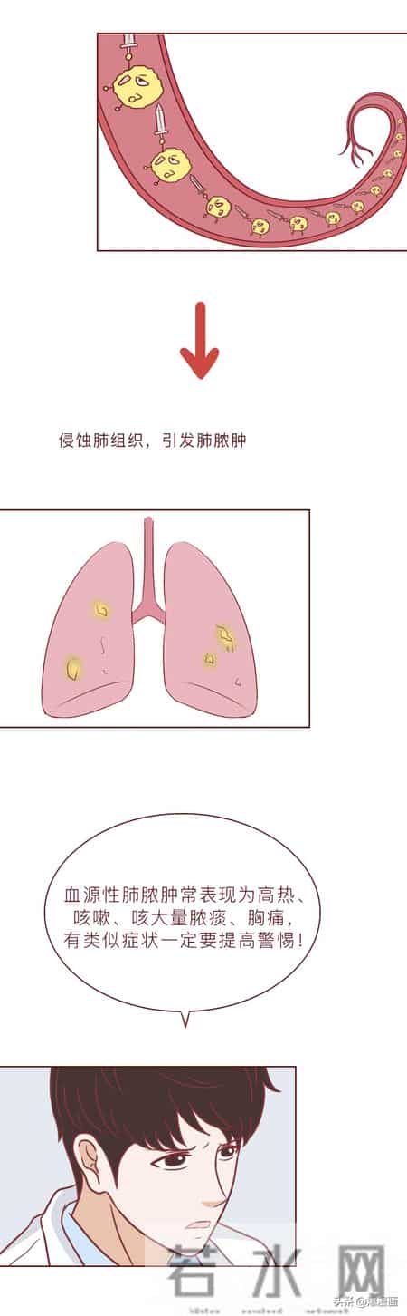 因为这个小动作，我差点被送进ICU，甚至有人被颅内感染