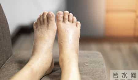 医生劝告：跟尿毒症病人一起吃饭，一定注意2件事，千万别忽视！