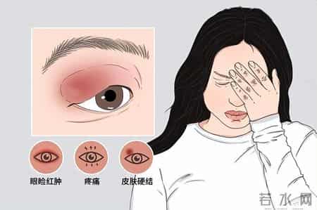 人有没有肾衰竭，看平常就知？肾病患者，日常有这6个表现！