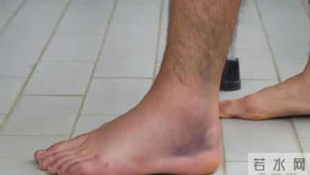 65岁大爷血压骤降昏迷，医生：苯磺酸氨氯地平不可和这5种药搭配