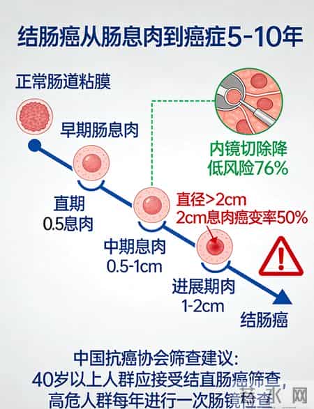95%治愈vs15%生存！一张图看懂结肠癌是怎么从息肉变出来的