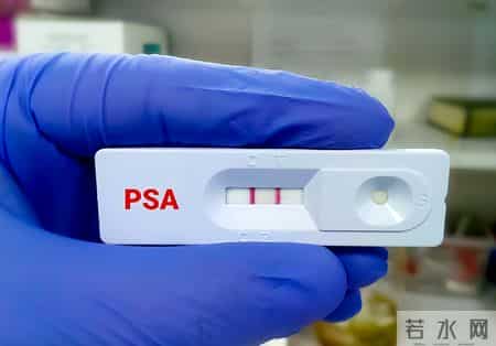 多名医生提醒：只要做过前列腺B超，中老年男性务必重视这2指标！