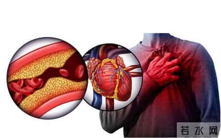 调查发现：活得久的冠心病患者，大多在确诊后，改掉了8个恶习