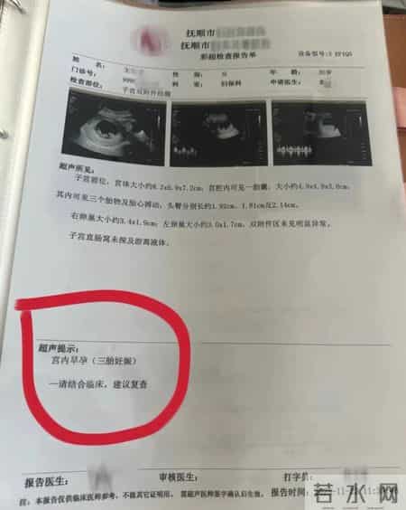 孕妇两个月内从一胎变四胞胎，每次产检都多出一胎！医生：系同卵四胞胎，概率1300万至1500万分之一！