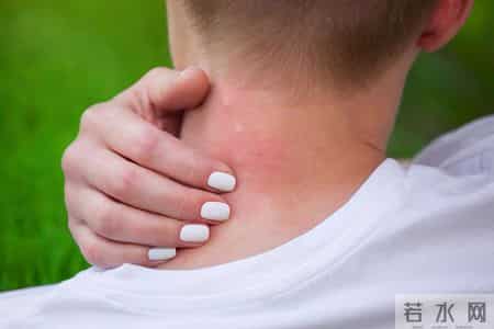 身上4处发痒，竟被确诊癌症！男子崩溃：以为只是简单过敏