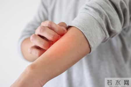 肾内科医生提醒：这5种不舒服其实是尿毒症，千万别忽视，速看