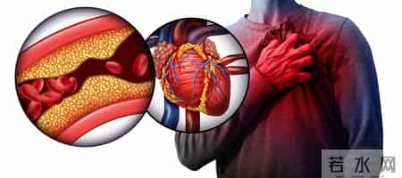 以为只是累了，其实是血管堵了，医生：心梗来前身体早就报警了