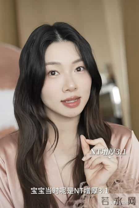 程晓玥透露二胎因吃药导致NT异常！羊水穿刺伤口令人心疼