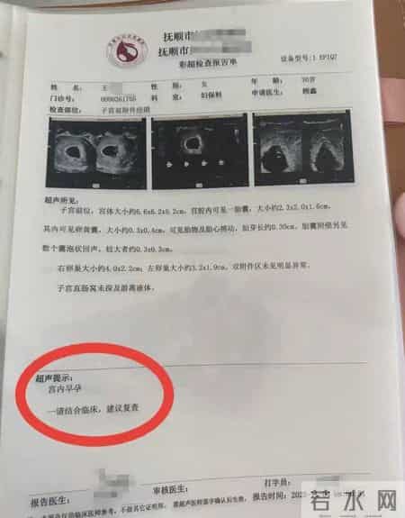 罕见！辽宁一孕妇两个月内产检从一胎“变”四胞胎