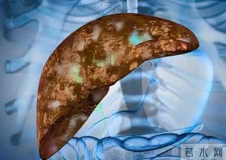 46岁男子皮肤瘙痒以为是海鲜过敏，检查结果出来傻眼了：肝癌晚期