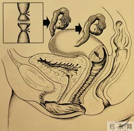 盆底肌松弛 = 产后不可逆？错！3 个居家训练，4 周恢复紧致