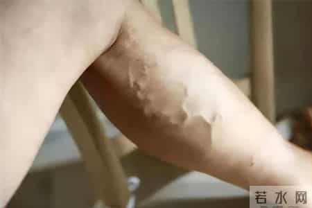 山东一66岁大妈喜欢睡前泡脚，不久脑梗去世，医生怒斥：太无知了