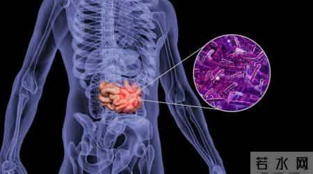 为啥很多人不愿意做肠镜？外国研究：做一次肠镜，或保十年安全？