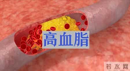 多名医生忠告：高血脂患者做完血脂四项检测，务必牢记 4 关键结果