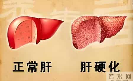 医师调查发现：每日饮酒的糖尿病人，多数临近62岁或有3种异样