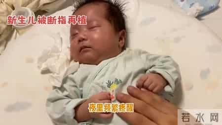 揪心！新生儿断指插钢针日夜哭，手术成功却遭罪，家长崩溃了