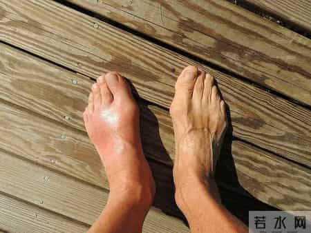 寿命长不长，先查尿酸？医生：年过65岁，尿酸超标小心连累全身