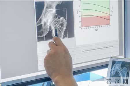 晒太阳补钙是假的？骨科医生：人老了想补钙，这5事比晒太阳重要