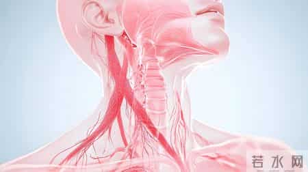 超1.2亿国人查出颈动脉斑块！医生提醒：坚持3点或有望逆转斑块