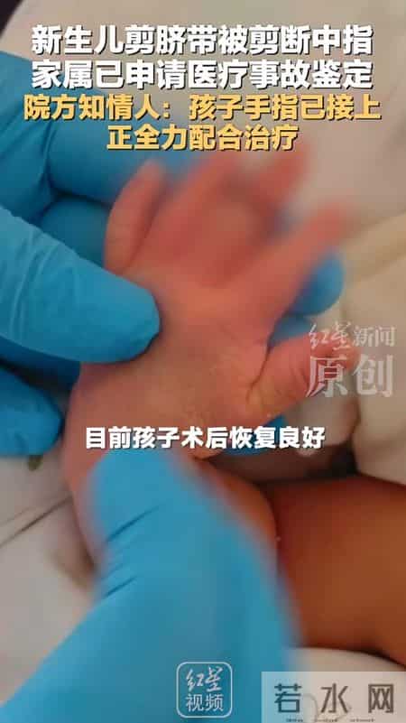 新生儿被剪断中指，助产士甩锅孩子乱动，家属还原经过，院方回应
