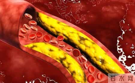 医生告诫：只需改变早餐，不仅胆固醇下降了，各个指标都稳定了