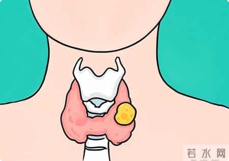 中医提醒：甲状腺有“结节”，可能和这2个坏习惯有关，及时改掉