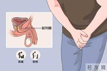 前列腺增生患者一旦活过78岁，大多出现如下3个症状，看看占几个