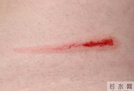 血糖偏高，若没有这6种异常感觉，离糖尿病还远！不必过度恐慌