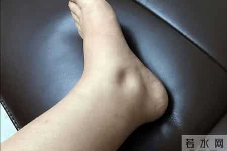 肾脏开始衰竭，排尿先知？医生提醒：排尿出现3异常，尽快去医院