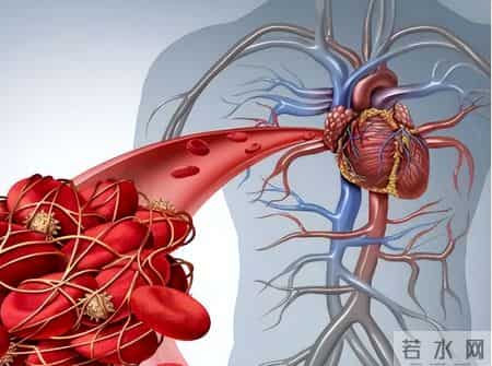 专家研究：每天多吃一个鸡蛋，糖尿病和类风湿或会增加？可信吗？