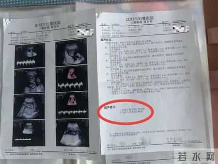 一孕妇两个月内从一胎变四胞胎，每次产检都发现多出一胎！医生解释