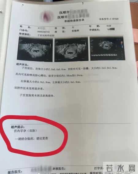 一孕妇每次产检都多出一胎，两个月内从一胎变四胞胎！医生回应→