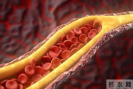 男子因脑梗不幸走了！提醒：天冷宁愿在家打牌，也别干这2事！