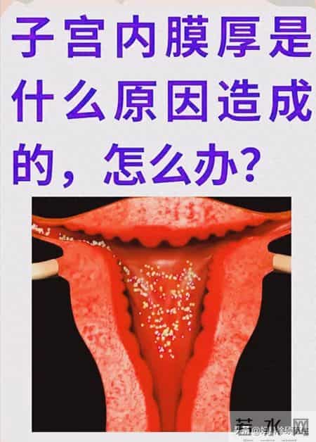 查出子宫内膜厚！调整生活方式真的有用吗？医生给你唠明白