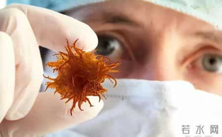 癌症去世的人越来越多！建议：2不喝、3不吃、2坚持，别马虎了！