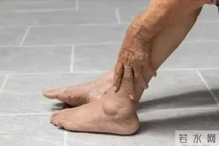 糖尿病加重的5个信号！医生：一旦出现就要重视，千万别拖延了