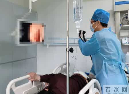 为啥很多人不愿意做肠镜？外国研究：做一次肠镜，或保十年安全？