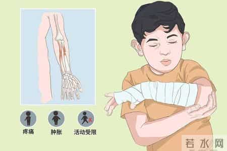 老人因钙不足骨折住院！医生提醒：平时少吃点腌菜，要多吃几物