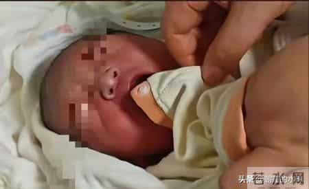 离谱！婴儿刚出生手指被当脐带剪断，全家心碎