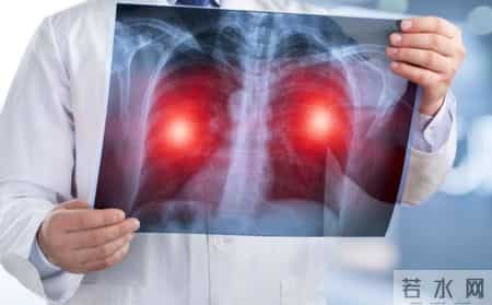 多名医生提醒：只要做过CT检查，中老年人务必重视这4指标！