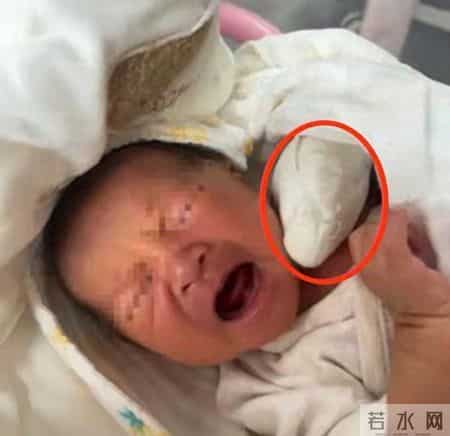 新生儿被剪断手指后续：父亲哭诉娃疼醒夜闹，孩子手未来功能成疑