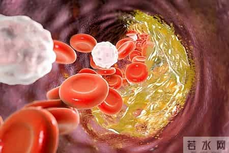 4个月，我从高胆固醇、高血脂症恢复到正常！背后值得借鉴！