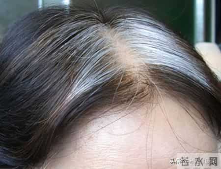 体检发现颈动脉斑块很危险？多数属生理退化，这样稳住就行