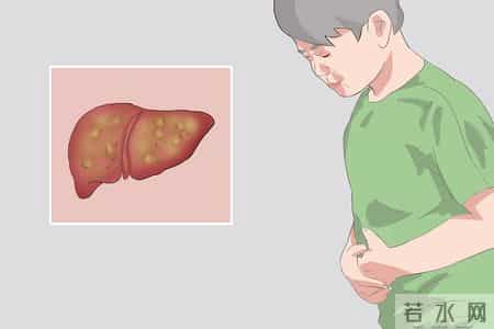 肝癌进展 5 个预警信号！忠告：出现一个就就医，别错过干预时机