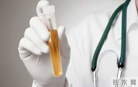 人有没有肾病，看喝水就知？医生：有肾病的人，喝水多会有8异常