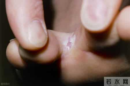 医生呼吁：最能加重糖尿病的行为，不是吃糖！而是频繁去做这4事