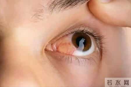 老年人眼睛越来越模糊？医生：或是4种疾病的讯号，别以为是老了