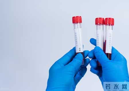 在血常规检查中，专家：这3项数值异常，可能是肿瘤信号！